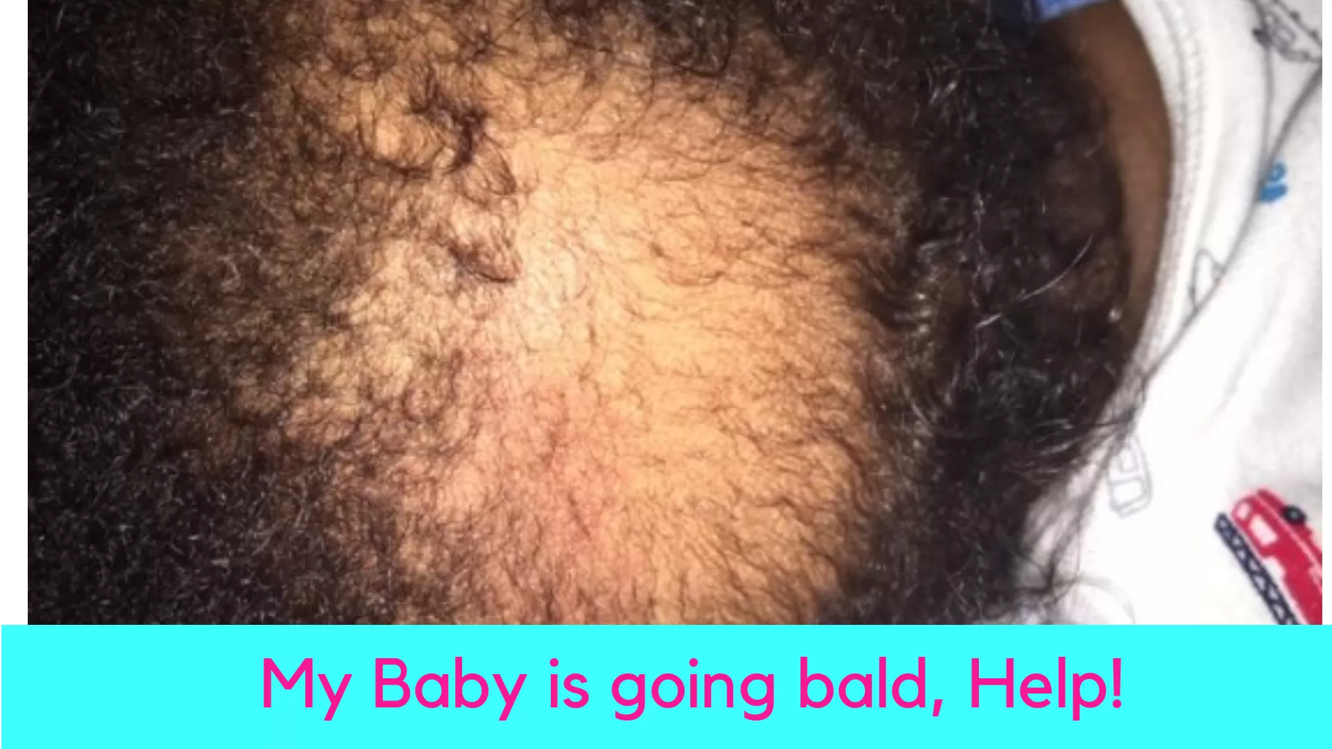 My Baby is going bald, Help!