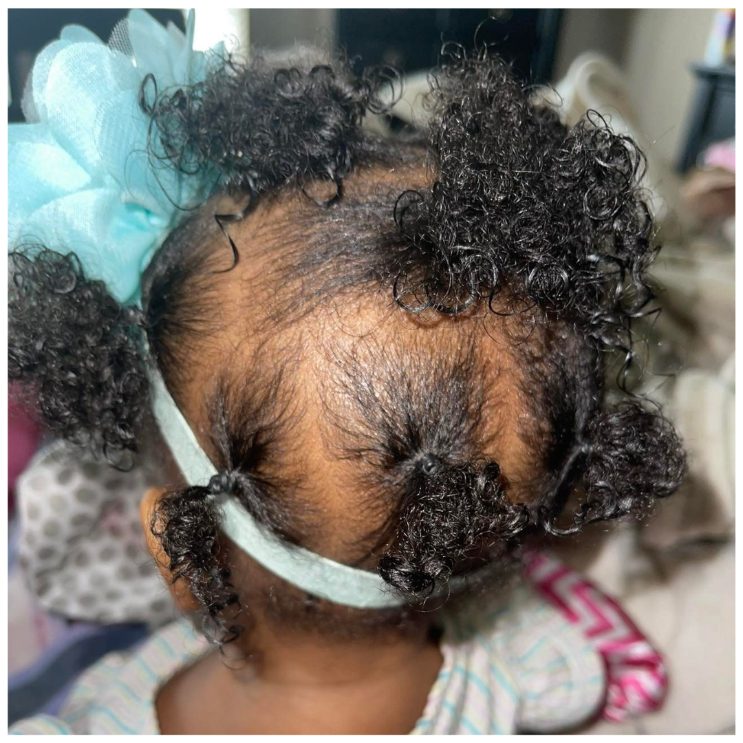 Baby Hair Care: The Complete Parent’s Guide | Kraddle Kare