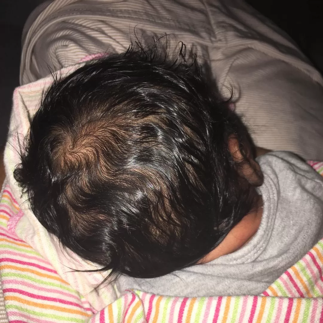Understanding Your Newborn’s Hair