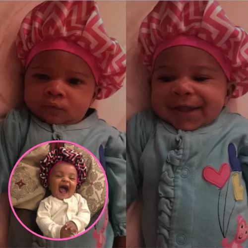 Introducing the Kraddle Kare Baby Satin Bonnet How to Understand Hair Loss in Babies? | When to Worry?