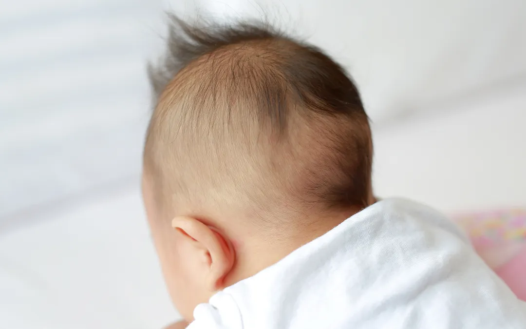 Why I Couldn't Stop Worrying About My Baby's Bald Spot as the Year Ended | Baby Bald Spot